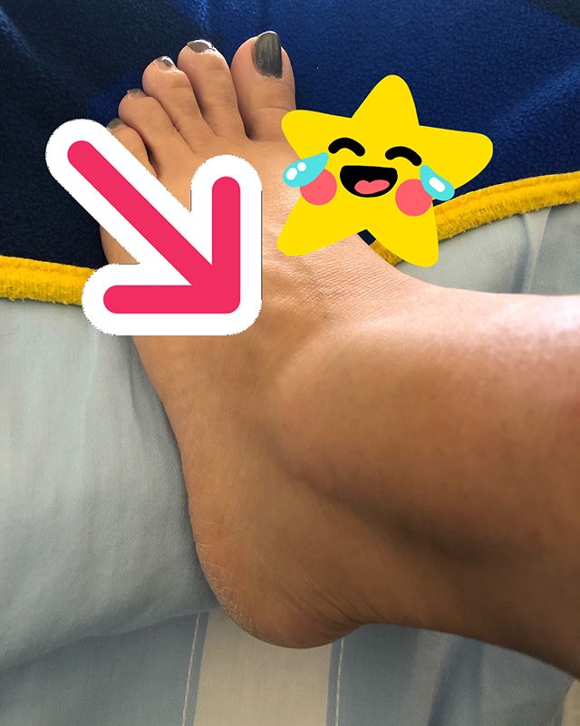 I sent @sasha8716 a good morning text with my gnarly-looking ankles. (Don’t ask, this is how runners communicate with each other. 🤣). Yes, they look messed up and I won’t be winning any sexy ankle contests soon, but my “supersaiyan” ankles have carried me on 50 half-marathons, 19 Marathons, 9 ultramarathons and counting. #teamcankles P.s., yes I need a pedicure lol [instagram]